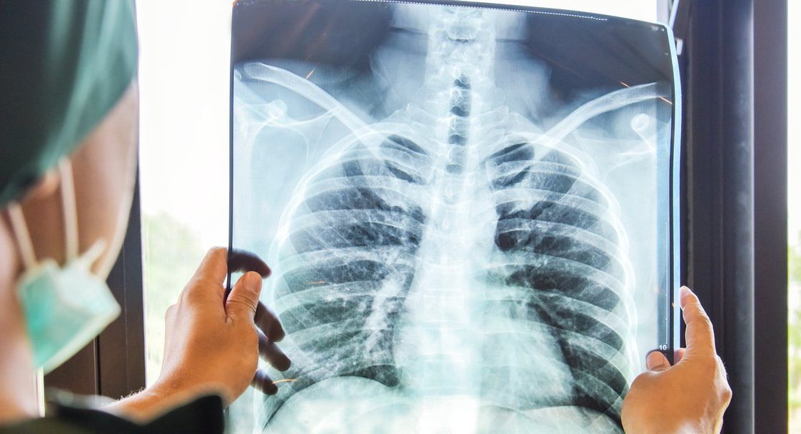 تشخیص المرض